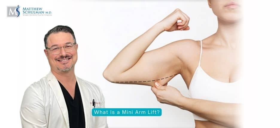 What Is a Mini Arm Lift