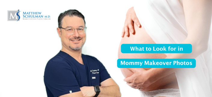 What To Look For In Mommy Makeover Photos