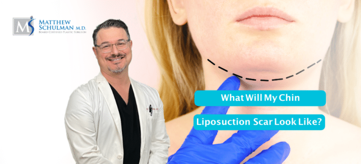 What Will My Chin Liposuction Scar Look Like