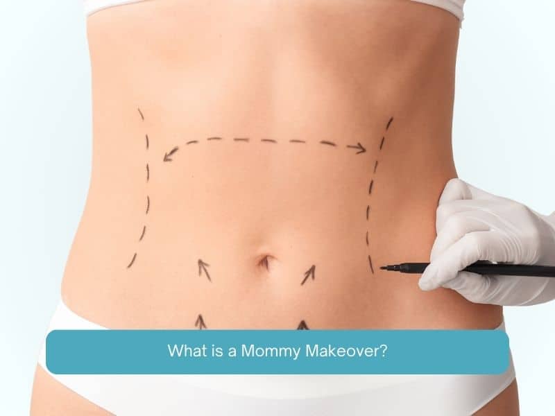 What is a Mommy Makeover
