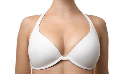 What is a breast lift called
