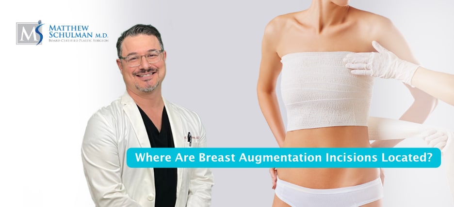 Where Are Breast Augmentation Incisions Located