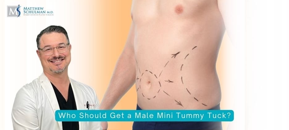 Who Should Get a Male Mini Tummy Tuck?