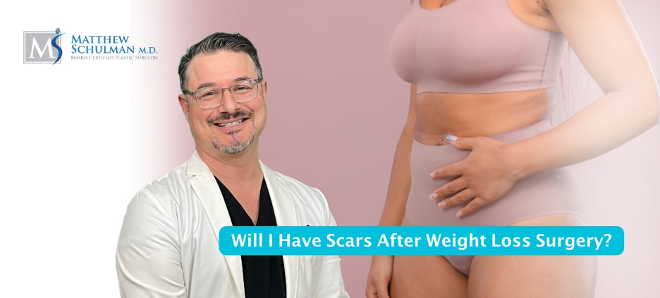 Will I Have Scars After Weight Loss Surgery