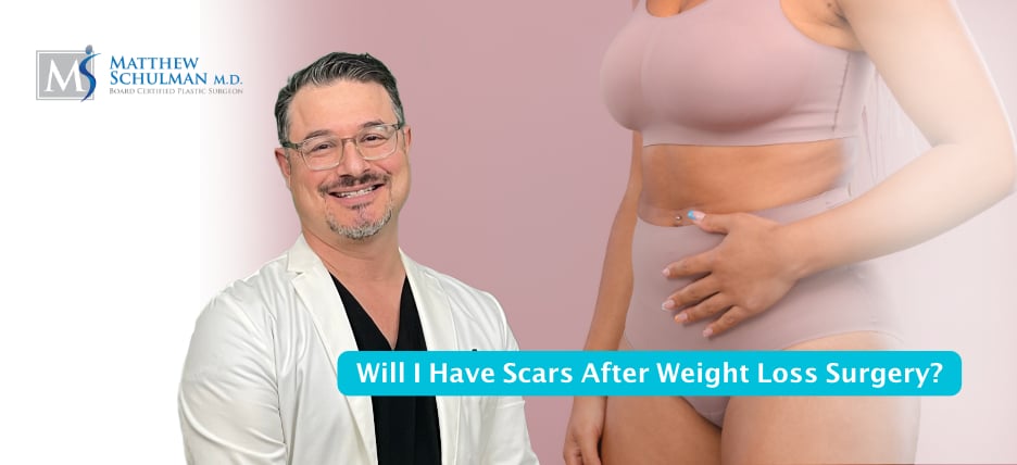Will I Have Scars After Weight Loss Surgery
