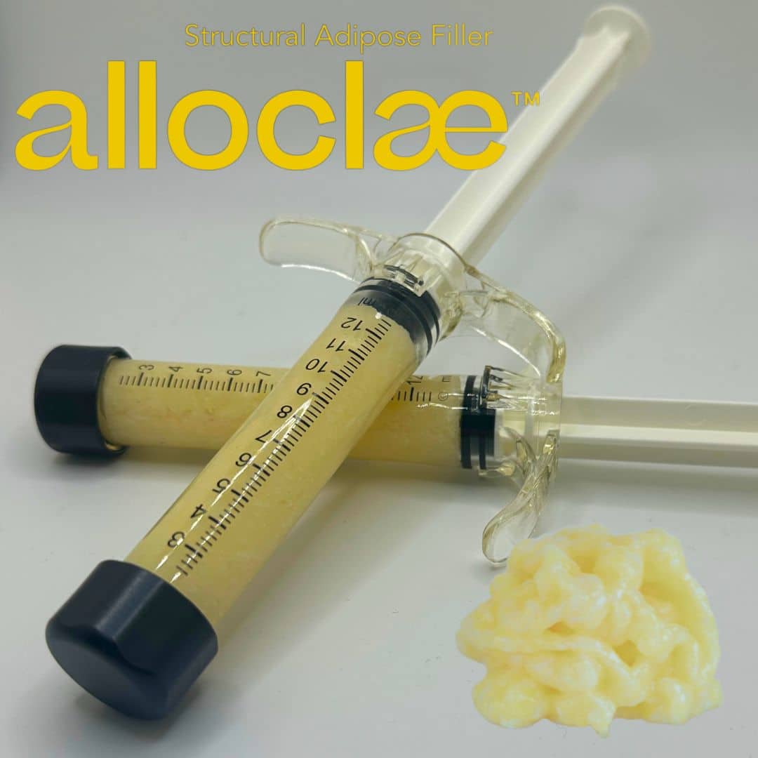 Alloclae New York City