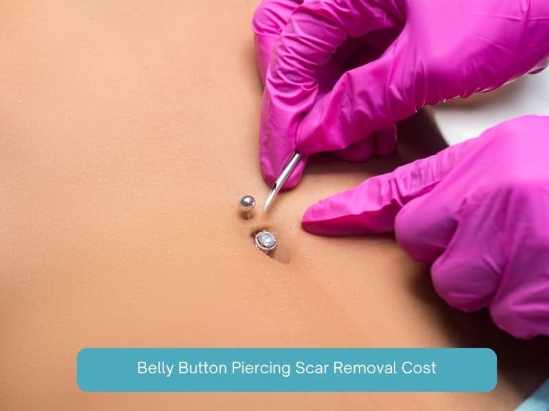 belly button piercing scar removal cost
