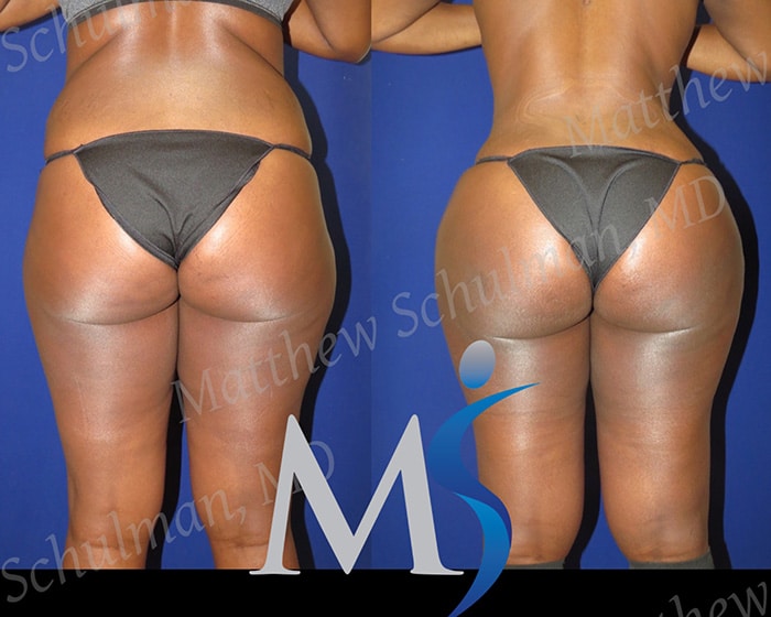 Brazilian Butt Gift Philadelphia