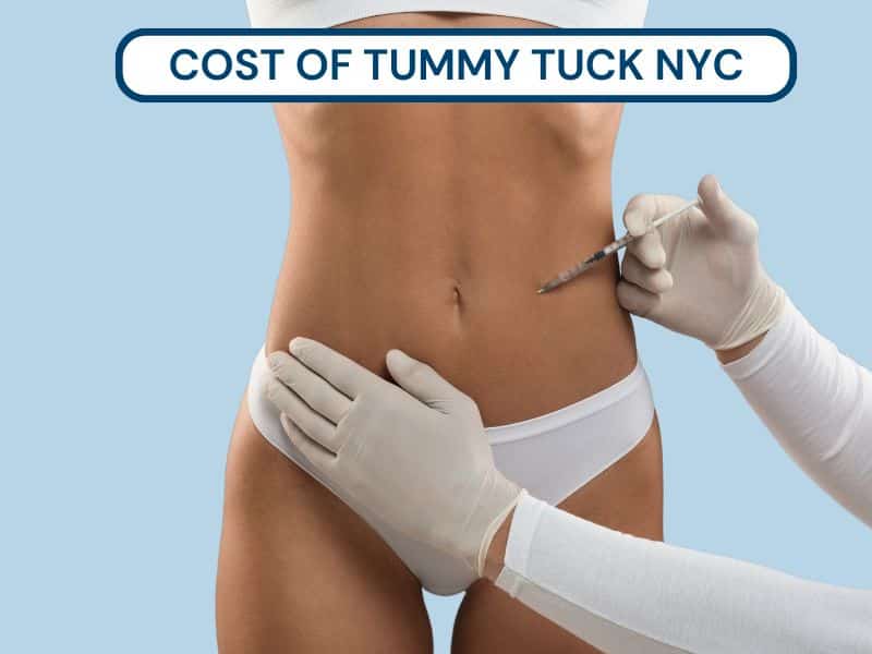 cost of tummy tuck nyc