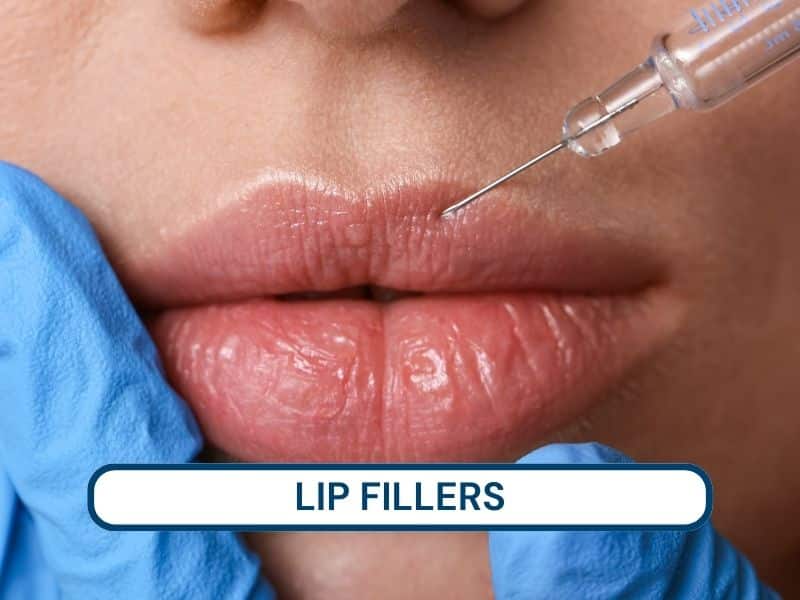 lip fillers