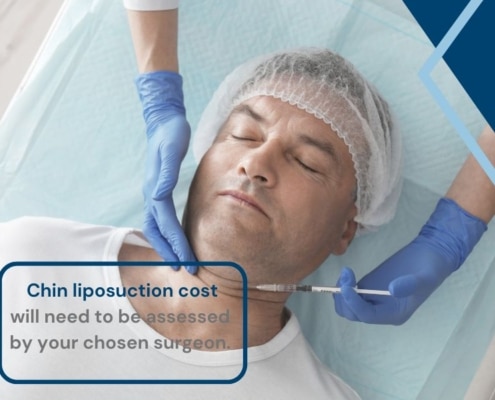 lipo under chin cost