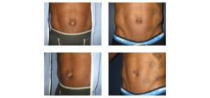 New-York-City-Belly-Button-3
