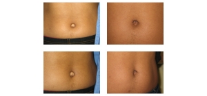 New-York-City-Belly-Button-4