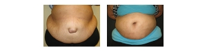 New-York-City-Belly-Button-6
